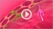 Cystistat video